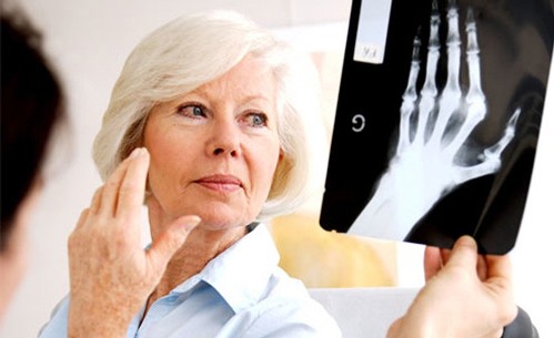Artritis Reumatoide Y Su Tratamiento